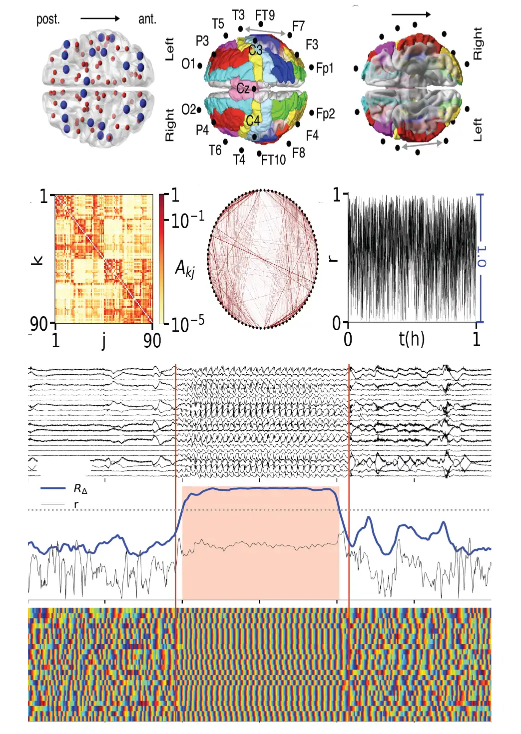 FitzHugh-Nagumo oscillators on complex networks
