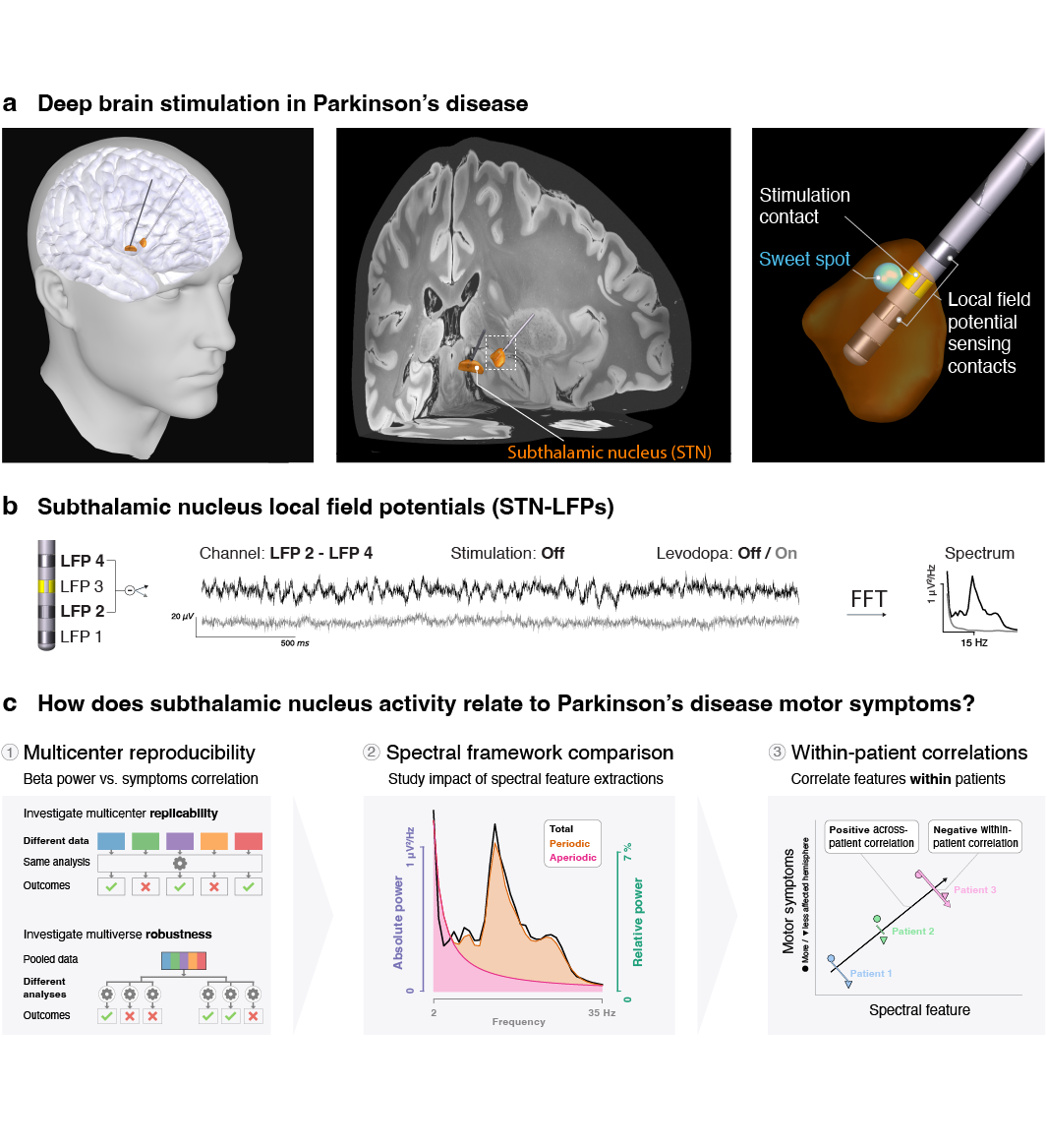 Subthalamic aperiodic broadband power and Parkinson's disease severity